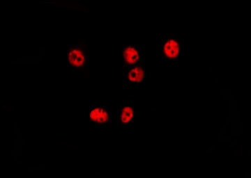 Phospho-p38 MAPK (Tyr182) Antibody in Immunocytochemistry (ICC/IF)