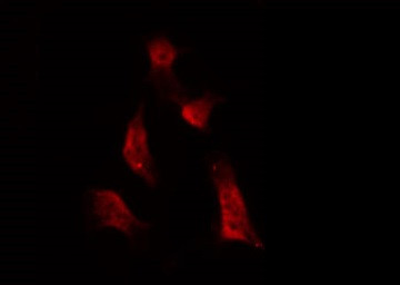 Phospho-ATRIP (Ser68) Antibody in Immunocytochemistry (ICC/IF)
