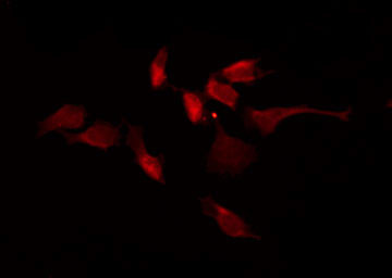 Phospho-CaMKII alpha/beta/delta (Thr305) Antibody in Immunocytochemistry (ICC/IF)