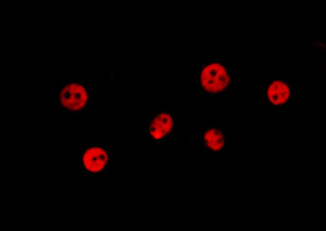 TWIST1 Antibody in Immunocytochemistry (ICC/IF)