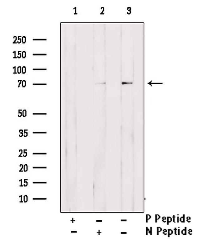 Phospho-GAB2 (Ser623) Antibody in Western Blot (WB)