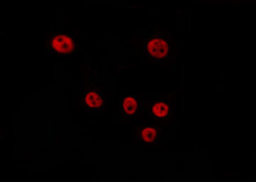 Phospho-Cyclin D2 (Thr280) Antibody in Immunocytochemistry (ICC/IF)