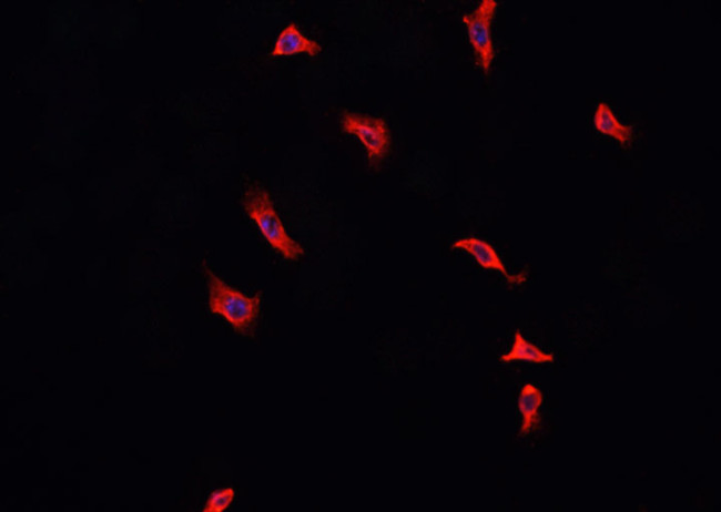 Phospho-Annexin A2 (Ser26) Antibody in Immunocytochemistry (ICC/IF)