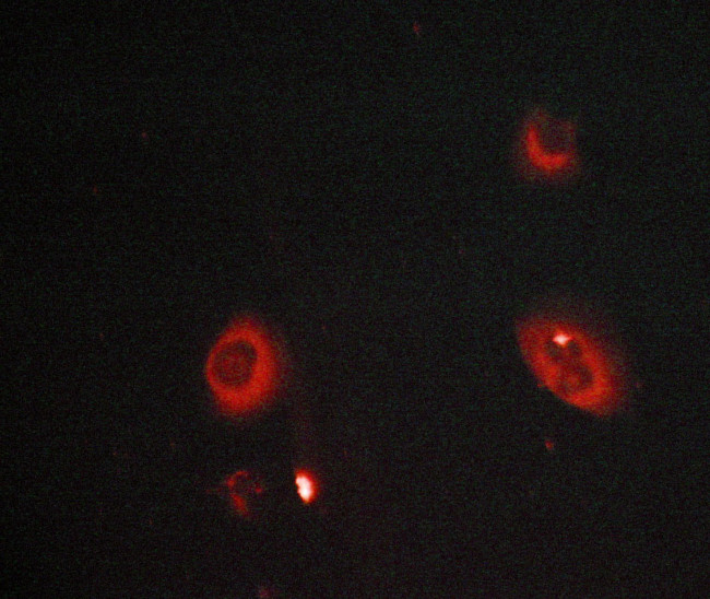 MMP8 Antibody in Immunocytochemistry (ICC/IF)