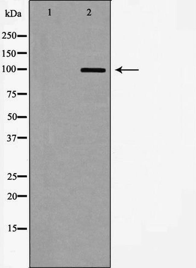 mGluR8 Antibody in Western Blot (WB)
