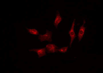 Phospho-NFkB p50/p105 (Ser903) Antibody in Immunocytochemistry (ICC/IF)