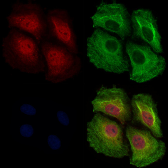 Phospho-NFkB p50/p105 (Ser923) Antibody in Immunocytochemistry (ICC/IF)