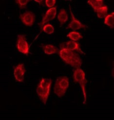 Phospho-CHK2 (Ser19) Antibody in Immunocytochemistry (ICC/IF)