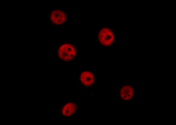 Phospho-CHK2 (Thr26, Ser28) Antibody in Immunocytochemistry (ICC/IF)