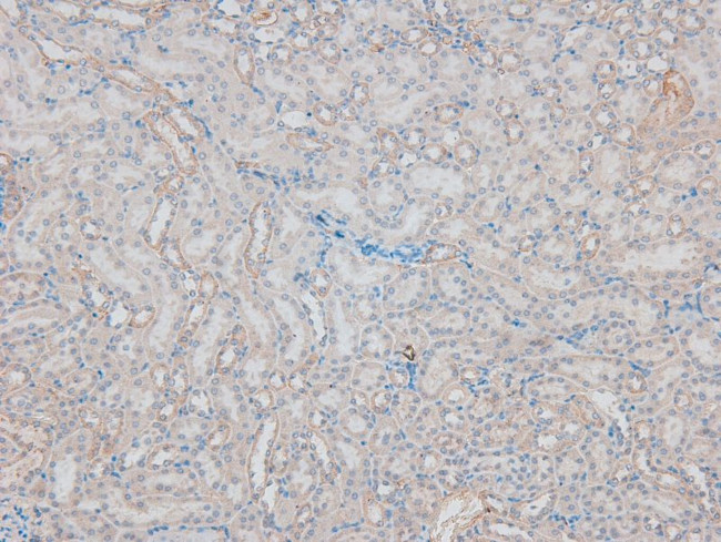 Phospho-FES (Tyr713) Antibody in Immunohistochemistry (Paraffin) (IHC (P))