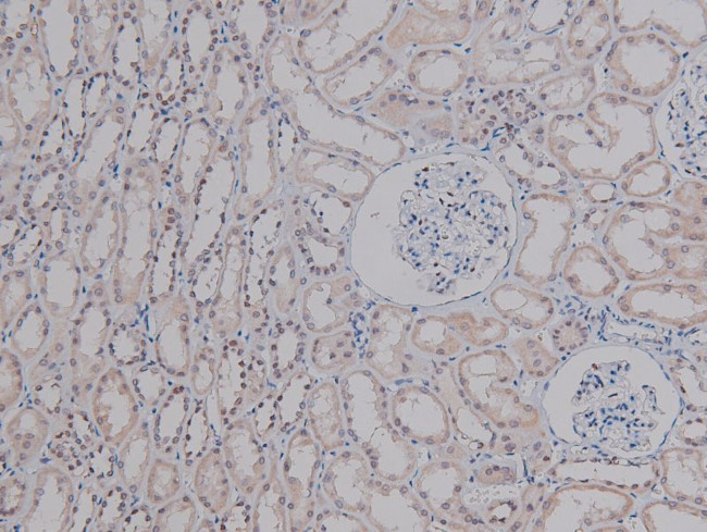 Phospho-c-Jun (Ser249) Antibody in Immunohistochemistry (Paraffin) (IHC (P))