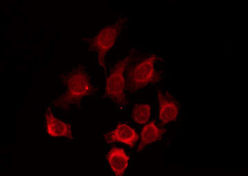Phospho-SMAD1 (Ser214) Antibody in Immunocytochemistry (ICC/IF)