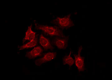 Phospho-SMAD2 (Ser245) Antibody in Immunocytochemistry (ICC/IF)
