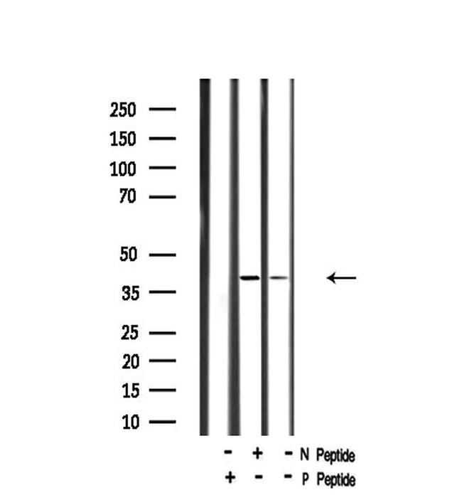 Phospho-GNAZ (Ser16) Antibody in Western Blot (WB)