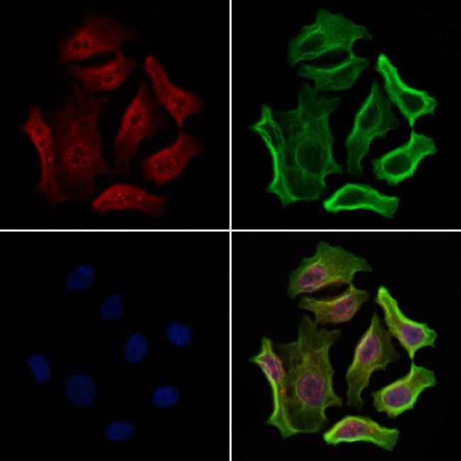 Phospho-HSF1 (Ser307) Antibody in Immunocytochemistry (ICC/IF)