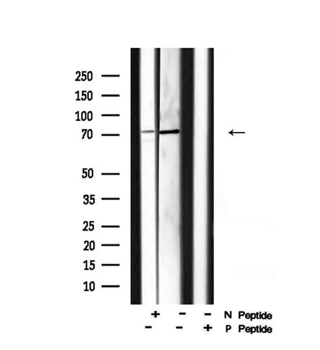 Phospho-CENTB1 (Ser554) Antibody in Western Blot (WB)
