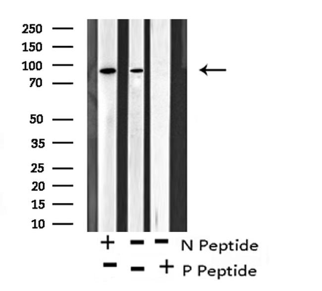 Phospho-PKD2 (Ser812) Antibody in Western Blot (WB)