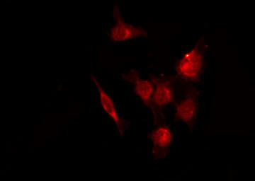 Phospho-Cdc25A (Ser82) Antibody in Immunocytochemistry (ICC/IF)