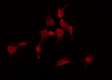 Phospho-eNOS (Ser633) Antibody in Immunocytochemistry (ICC/IF)