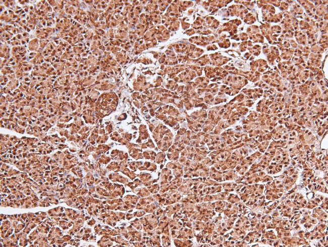Phospho-FOXO4 (Thr455) Antibody in Immunohistochemistry (Paraffin) (IHC (P))