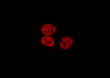 Phospho-STAT4 (Ser721) Antibody in Immunocytochemistry (ICC/IF)