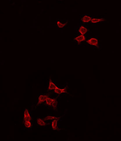 Phospho-VEGF Receptor 1 (Tyr1242) Antibody in Immunocytochemistry (ICC/IF)