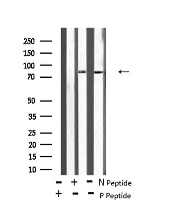 Phospho-STK29 (Thr260) Antibody in Western Blot (WB)
