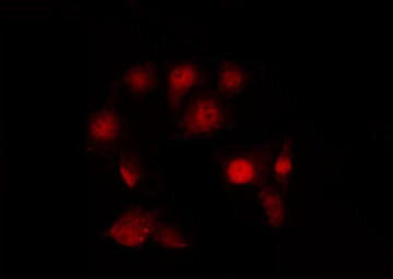 Phospho-JAK2 (Tyr119) Antibody in Immunocytochemistry (ICC/IF)