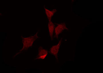 Phospho-PAK1 (Ser21) Antibody in Immunocytochemistry (ICC/IF)