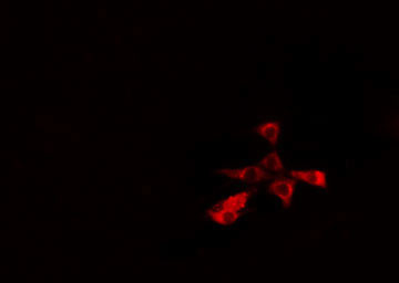 Phospho-PKC theta (Tyr90) Antibody in Immunocytochemistry (ICC/IF)
