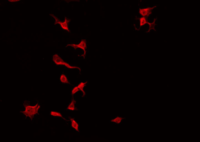 Phospho-TEK (Ser1119) Antibody in Immunocytochemistry (ICC/IF)