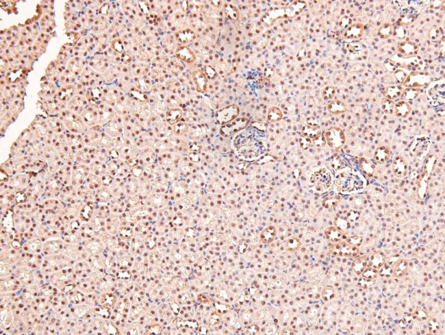 Phospho-RARA/RARB (Ser96) Antibody in Immunohistochemistry (Paraffin) (IHC (P))