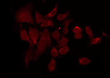 Phospho-FGFR1/FGFR2 (Tyr730, Tyr733) Antibody in Immunocytochemistry (ICC/IF)