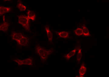 Phospho-BIK (Ser35) Antibody in Immunocytochemistry (ICC/IF)