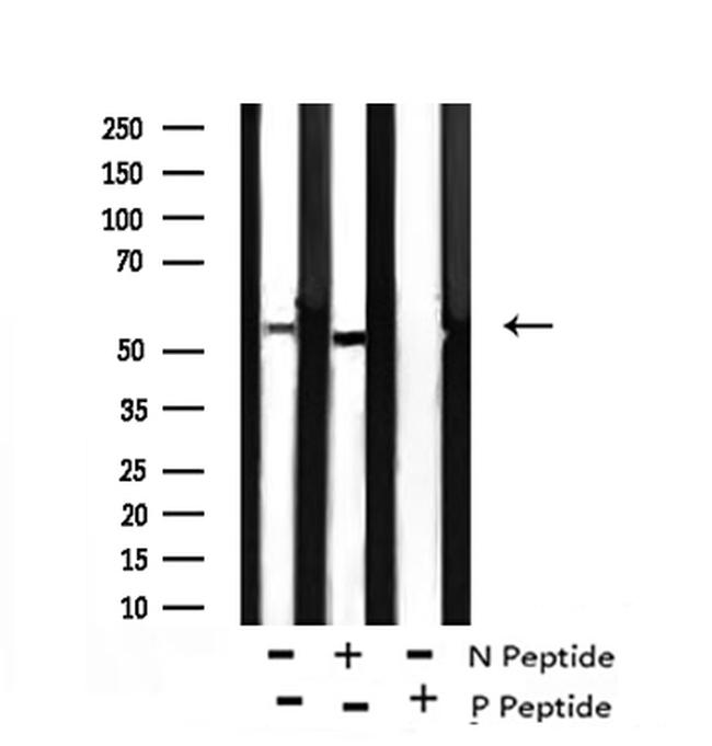 Phospho-Bora (Ser497) Antibody in Western Blot (WB)