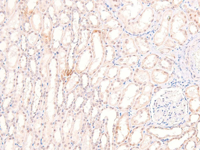 Phospho-Claspin (Ser30) Antibody in Immunohistochemistry (Paraffin) (IHC (P))
