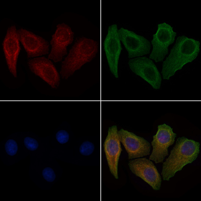 Phospho-Cyclin B1 (Ser133) Antibody in Immunocytochemistry (ICC/IF)