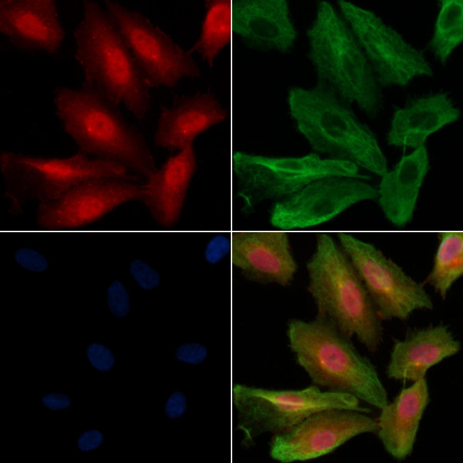 Phospho-FOXO3A (Ser318) Antibody in Immunocytochemistry (ICC/IF)