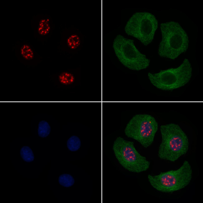 Phospho-JDP2 (Thr148) Antibody in Immunocytochemistry (ICC/IF)