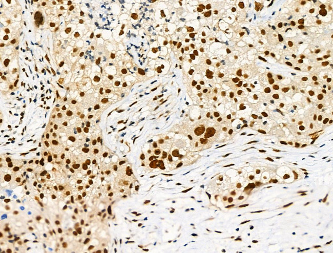 Phospho-LIMK1 (Ser310) Antibody in Immunohistochemistry (Paraffin) (IHC (P))