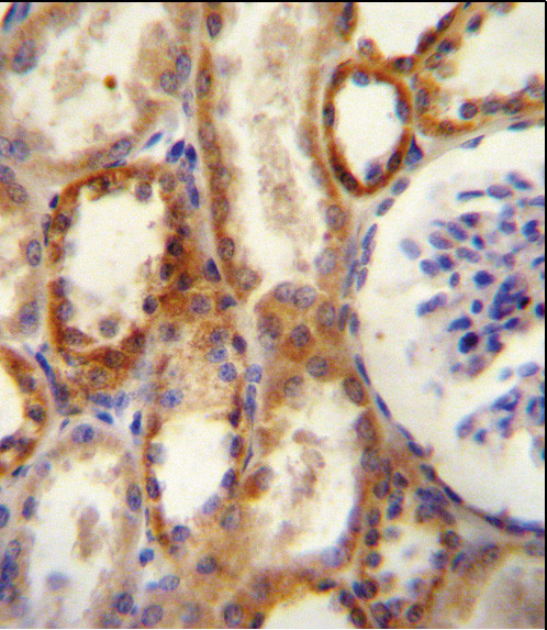 CD73 Antibody in Immunohistochemistry (Paraffin) (IHC (P))