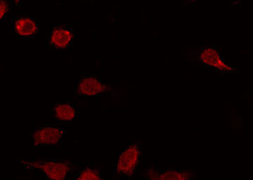 Phospho-SP1 (Thr278) Antibody in Immunocytochemistry (ICC/IF)