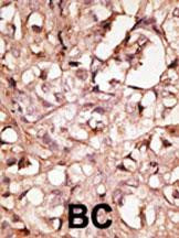LYVE1 Antibody in Immunohistochemistry (Paraffin) (IHC (P))
