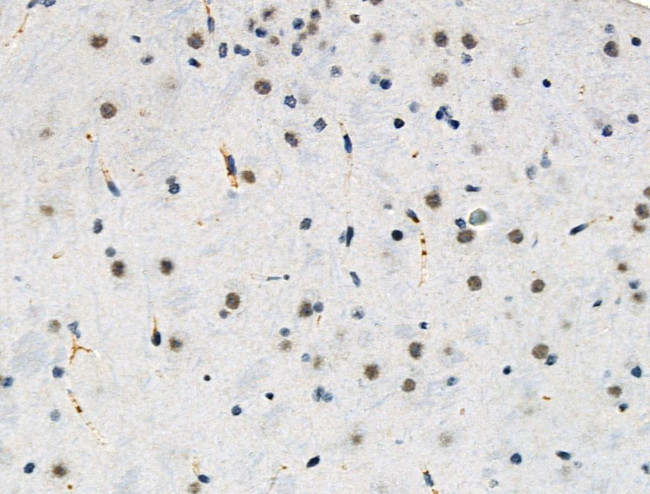Phospho-ETV6 (Ser257) Antibody in Immunohistochemistry (Paraffin) (IHC (P))