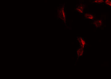 Phospho-53BP1 (Ser1778) Antibody in Immunocytochemistry (ICC/IF)