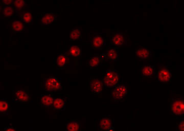 Phospho-POLR2A (Ser2, Ser1616) Antibody in Immunocytochemistry (ICC/IF)