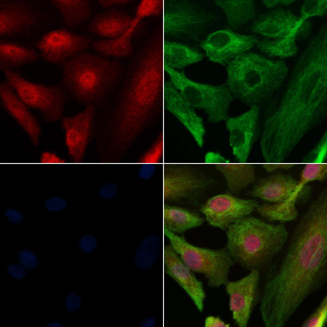Phospho-PRK1/PRK2 (Thr774, Thr816) Antibody in Immunocytochemistry (ICC/IF)