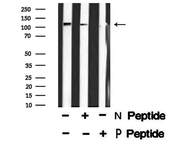 Phospho-PRK1/PRK2 (Thr774, Thr816) Antibody in Western Blot (WB)