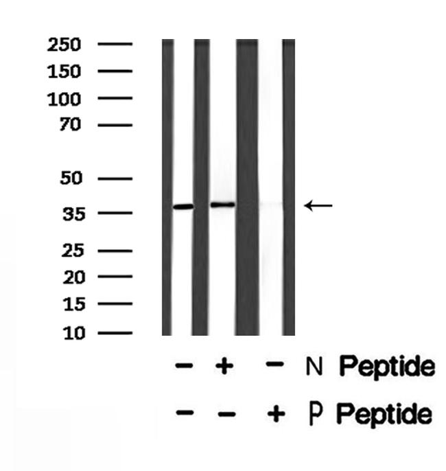 Phospho-C5AR1 (Ser334) Antibody in Western Blot (WB)
