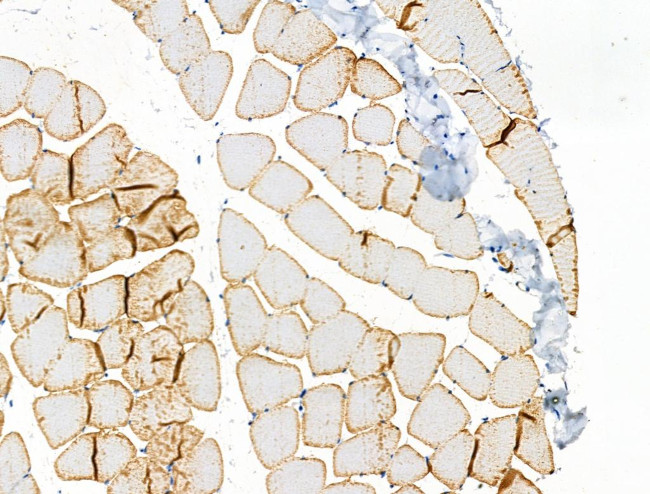 Phospho-ASAP2 (Ser701) Antibody in Immunohistochemistry (Paraffin) (IHC (P))